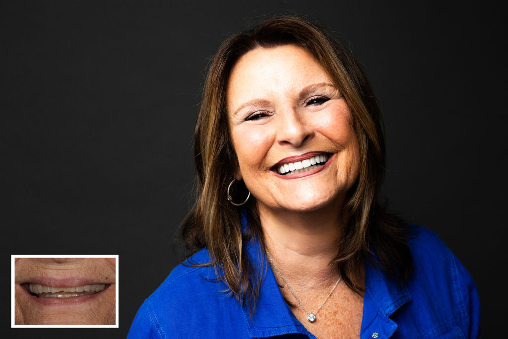 , Top 5 things to know when considering cosmetic dentistry