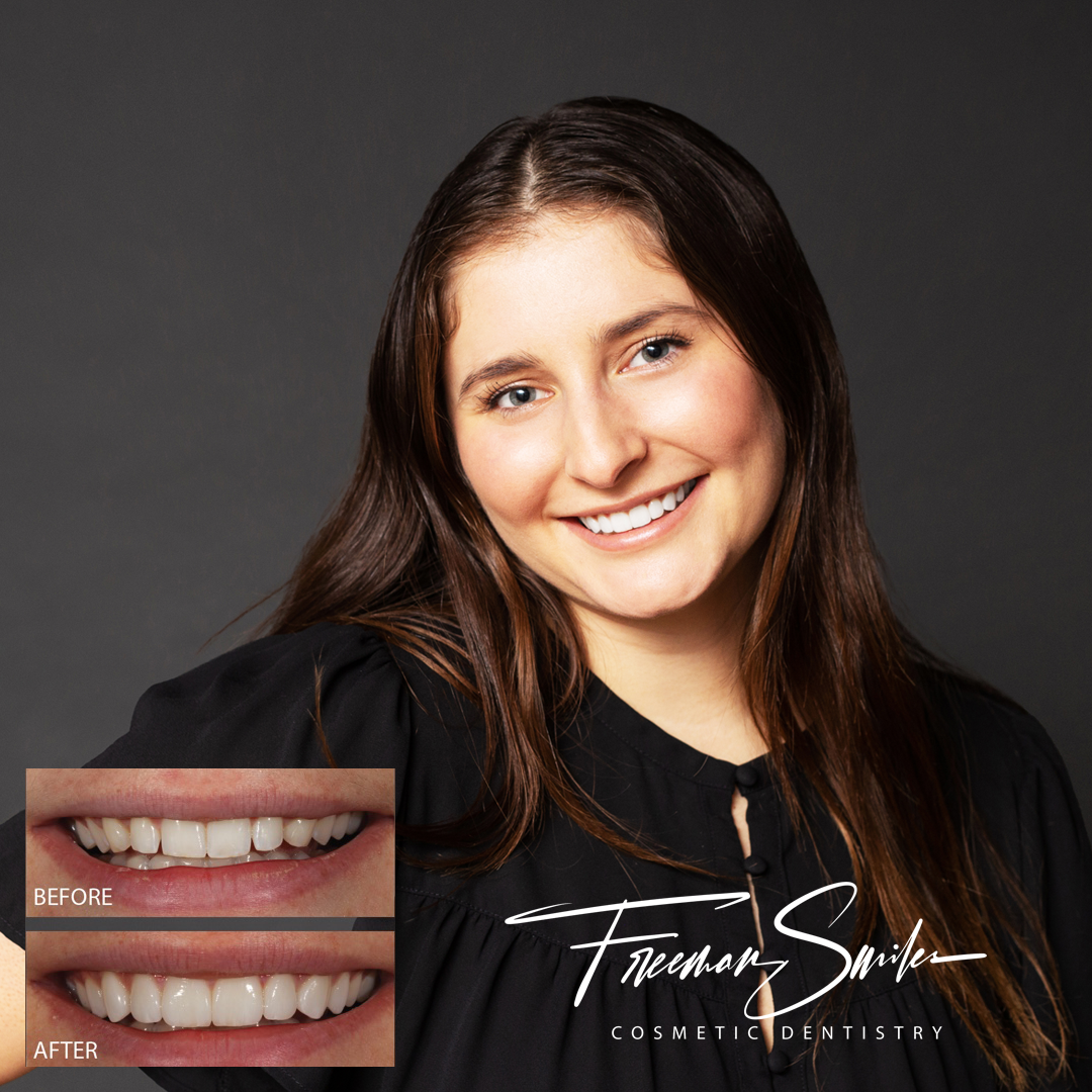 , CASE STUDY: Grace