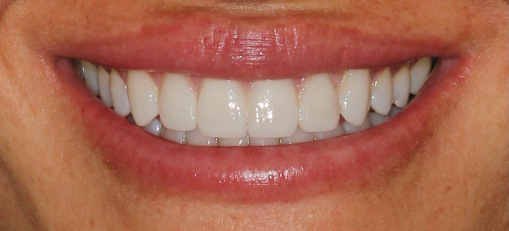 jessica after , CASE STUDY: JESSICA