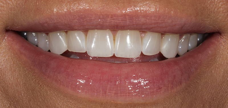 miranda before , CASE STUDY: JADE