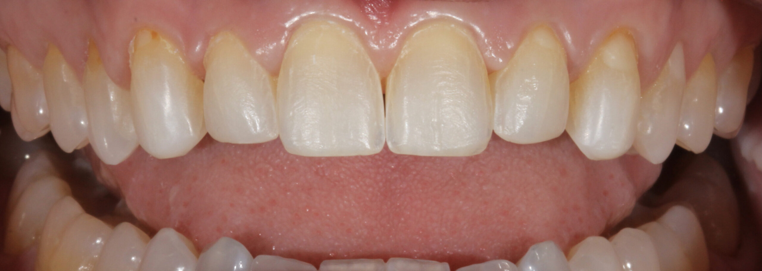 IMG_3136 , CASE STUDY: JADE