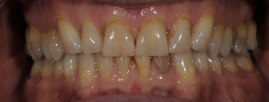 , CASE STUDY: ROBERT