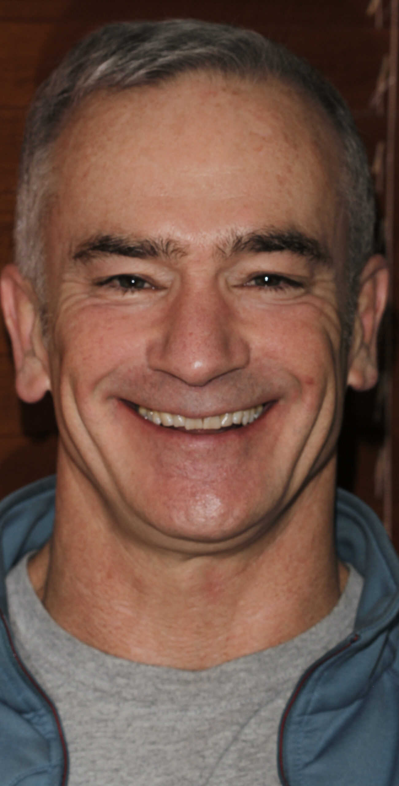 , CASE STUDY: ROBERT